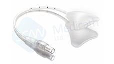 一次性使用三角球囊子宮支架