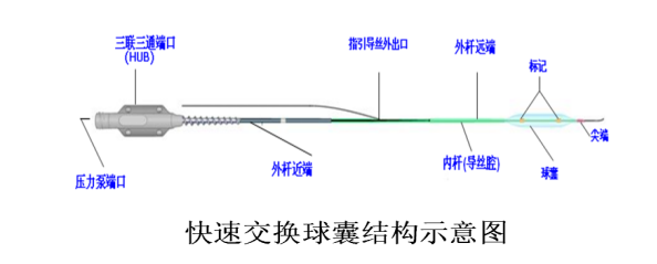 PTCA球囊導管的種類， 預擴張與后擴張是什么意思？