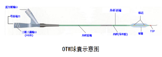 PTCA球囊導管的種類， 預擴張與后擴張是什么意思？