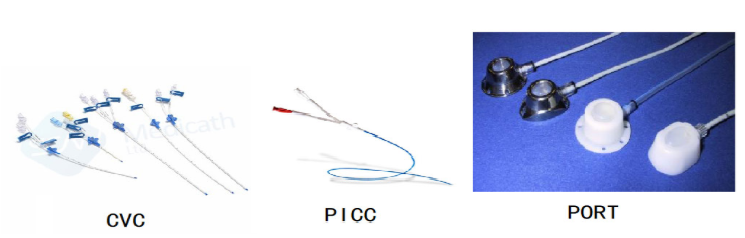 CVC、PICC、輸液港有什么區別？
