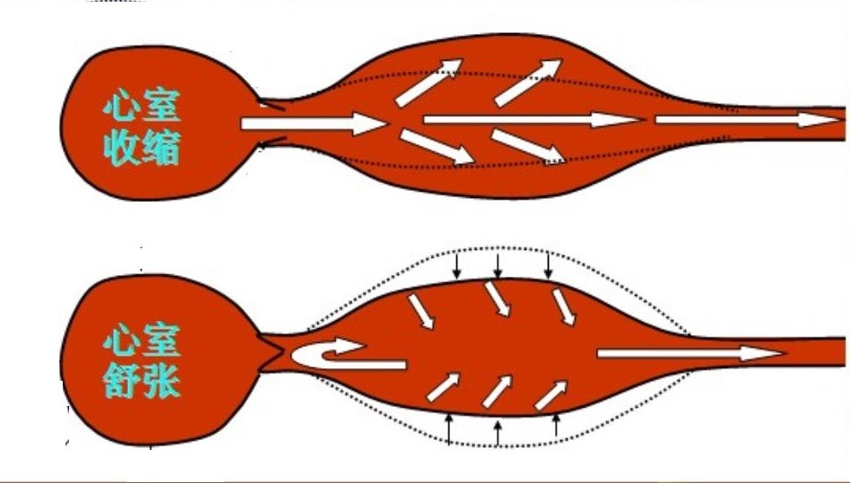  為什么需要做有創(chuàng)血壓監(jiān)測