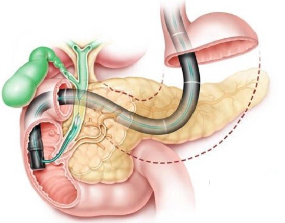 益心達(dá)又有多個(gè)產(chǎn)品獲上市許可