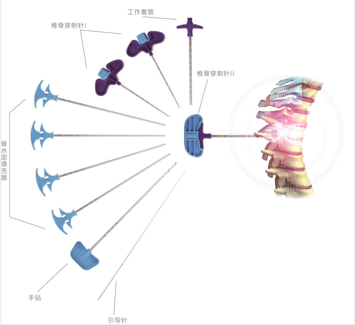 椎體成形擴張器簡介